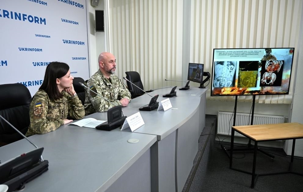 Вже не кулі: головний хірург ЗСУ розповів, що найбільше травмує бійців